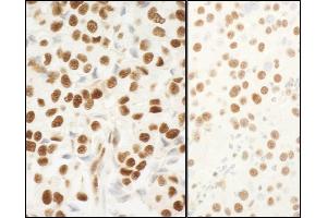 Immunohistochemistry (IHC) image for anti-Nucleophosmin (Nucleolar phosphoprotein B23, Numatrin) (NPM1) (AA 250-294) antibody (ABIN7453525)