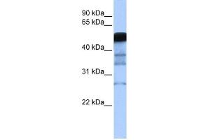 WB Suggested Anti-RAD18 Antibody Titration:  0. (RAD18 anticorps  (Middle Region))