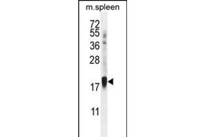 ZN Antibody (Center) (ABIN656018 and ABIN2845393) western blot analysis in mouse spleen tissue lysates (35 μg/lane). (ZNF593 anticorps  (AA 62-88))