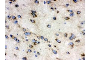 IHC testing of frozen mouse brain tissue with TCP1 antibody. (CCT4 anticorps)