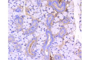Immunohistochemistry of paraffin-embedded mouse thyroid using ROCK1 antibody (ABIN4905028) at dilution of 1:100 (40x lens). (ROCK1 anticorps)