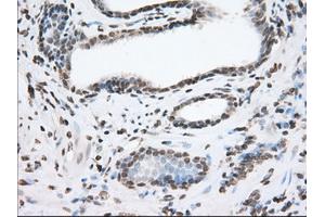 Immunohistochemical staining of paraffin-embedded Human liver tissue using anti-TACC3 mouse monoclonal antibody. (TACC3 anticorps)