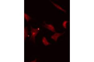 anti-DCP1 Decapping Enzyme Homolog A (S. Cerevisiae) (DCP1A) (Internal Region) antibody