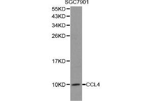 Western blot analysis of extracts of SGC7901 cell lines, using CCL4 antibody. (CCL4 anticorps  (C-Term))