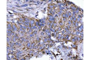 IHC analysis of EIF3A using anti-EIF3A antibody (ABIN7599942).