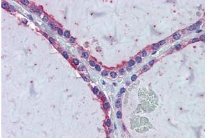 Thyroid, Human: Formalin-Fixed, Paraffin-Embedded (FFPE)