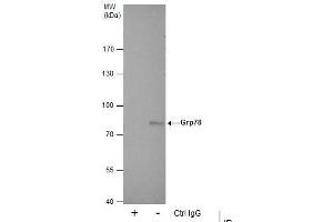 IP Image Immunoprecipitation of Grp78 protein from HepG2 whole cell extracts using 5 μg of Grp78 antibody [N2C1], Internal, Western blot analysis was performed using Grp78 antibody [N2C1], Internal, EasyBlot anti-Rabbit IgG  was used as a secondary reagent.