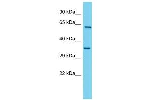 Host: Rabbit  Target Name: Mpp2  Sample Tissue: Rat Stomach lysates  Antibody Dilution: 1. (MPP2 anticorps  (C-Term))