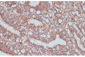 Immunohistochemistry of paraffin-embedded Rat ovary using MOB4 Polyclonal Antibody at dilution of 1:100 (40x lens). (MOBKL3 anticorps)
