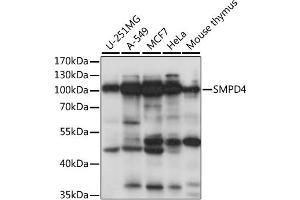 Western blot analysis of extracts of various cell lines, using SMPD4 antibody (ABIN6291650) at 1:1000 dilution. (SMPD4 anticorps)