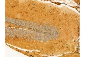 ABIN6265901 and ABIN6273084 at 1/100 staining Mouse brain tissue by IHC-P. (UQCRFS1 anticorps  (C-Term))