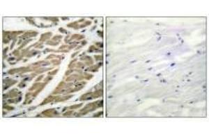 Immunohistochemical analysis of paraffin-embedded human heart tissue using Sodium Channel-pan antibody.