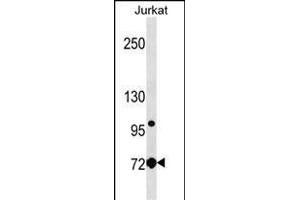 LCP1 Antibody (Center) (ABIN1538283 and ABIN2850258) western blot analysis in Jurkat cell line lysates (35 μg/lane). (LCP1 anticorps  (AA 306-335))