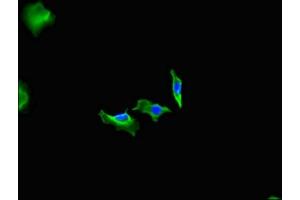 Immunofluorescent analysis of Hela cells using ABIN7152932 at dilution of 1:100 and Alexa Fluor 488-congugated AffiniPure Goat Anti-Rabbit IgG(H+L) (Fidgetin anticorps  (AA 132-371))