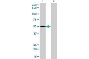 Western Blot analysis of ACP2 expression in transfected 293T cell line by ACP2 monoclonal antibody (M01), clone M1-4A12.
