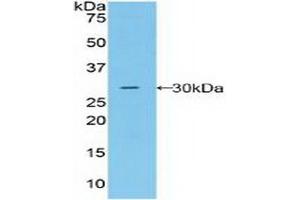 Detection of Recombinant MST1R, Human using Polyclonal Antibody to Macrophage Stimulating 1 Receptor (MST1R)