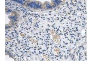 IHC-P analysis of Mouse Uterus Tissue, with DAB staining. (PCYOX1 anticorps  (AA 249-505))