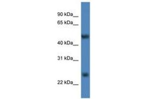 Image no. 1 for anti-Methyltransferase Like 4 (METTL4) (AA 361-410) antibody (ABIN6746295) (METTL4 anticorps  (AA 361-410))