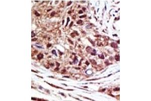 Image no. 1 for anti-Ubiquitin Specific Peptidase 14 (USP14) (N-Term) antibody (ABIN357546)