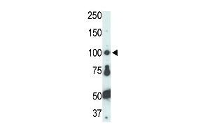 Antibody is used in Western blot to detect FER in HL-60 cell lysate.