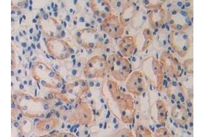 Detection of IL11Ra in Mouse Kidney Tissue using Polyclonal Antibody to Interleukin 11 Receptor Alpha (IL11Ra) (IL11RA anticorps  (AA 59-217))