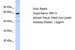 Host: Rabbit Target Name: ZNF74 Sample Tissue: Human Fetal Liver Antibody Dilution: 1ug/ml (ZNF74 anticorps  (N-Term))