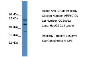 WB Suggested Anti-ICAM1  Antibody Titration: 0. (ICAM1 anticorps  (N-Term))