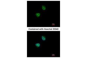 ICC/IF Image Immunofluorescence analysis of paraformaldehyde-fixed HeLa, using S6K2, antibody at 1:500 dilution. (RPS6KB2 anticorps  (Center))
