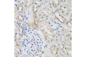 Immunohistochemistry of paraffin-embedded rat kidney using UBE3A antibody.