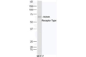 Human MCF-7 cell lysates probed with Rabbit Anti-ACVR2B/ACTR-IIB Polyclonal Antibody, Unconjugated  at 1:5000 for 90 min at 37˚C.