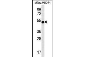 ST Antibody (Center) (ABIN656667 and ABIN2845907) western blot analysis in MDA-M cell line lysates (35 μg/lane). (STAP2 anticorps  (AA 187-216))