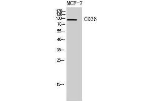 Western Blotting (WB) image for anti-CD36 (CD36) (Internal Region) antibody (ABIN3178931) (CD36 anticorps  (Internal Region))