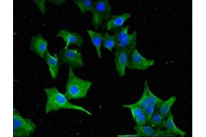 Immunofluorescent analysis of Hela cells using ABIN7154711 at dilution of 1:100 and Alexa Fluor 488-congugated AffiniPure Goat Anti-Rabbit IgG(H+L)