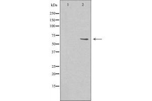 Western blot analysis of MARCKS expression in 293 cells.