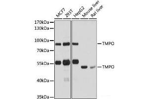 Western blot analysis of extracts of various cell lines using TMPO Polyclonal Antibody at dilution of 1:1000. (Thymopoietin anticorps)