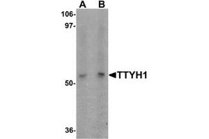 Western blot analysis of TTYH1 in Raji cell lysate with TTYH1 antibody at (A) 1 and (B) 2 ug/mL. (TTYH1 anticorps  (C-Term))