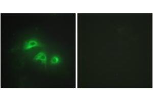 Immunofluorescence analysis of HepG2 cells, using KAD1 Antibody . (Adenylate Kinase 1 anticorps  (AA 101-150))