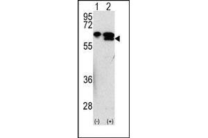 Image no. 1 for anti-Matrix Metallopeptidase 3 (Stromelysin 1, Progelatinase) (MMP3) (Middle Region) antibody (ABIN358700) (MMP3 anticorps  (Middle Region))