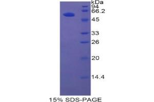 SDS-PAGE analysis of Rat HGFAC Protein. (HGFA Protéine)