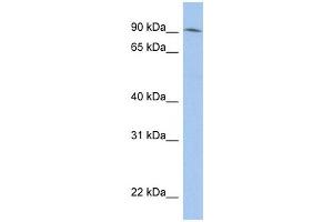 LRRC33 antibody used at 1 ug/ml to detect target protein. (LRRC33 anticorps  (N-Term))
