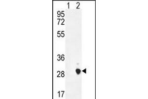 Western blot analysis of CSH1 (arrow) using rabbit polyclonal CSH1 Antibody (C-term) (ABIN654883 and ABIN2844537). (CSH1 anticorps  (C-Term))