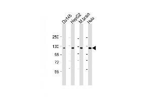 Lane 1: Du145, Lane 2: HepG2, Lane 3: mouse brain, Lane 4: Hela cell lysate at 20 µg per lane, probed with bsm-51347M DAB2IP (1626CT702. (DAB2IP anticorps)