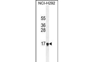 HEPN1 Antibody (N-term) (ABIN654808 and ABIN2844482) western blot analysis in NCI- cell line lysates (35 μg/lane). (HEPN1 anticorps  (N-Term))