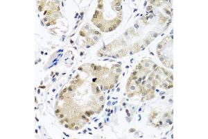 Immunohistochemistry of paraffin-embedded human stomach using PCBP1 antibody at dilution of 1:100 (40x lens). (PCBP1 anticorps)