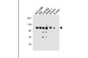 All lanes : Anti-XYLT1 Antibody (N-term) at 1:1000 dilution Lane 1: NCI- whole cell lysate Lane 2: 293 whole cell lysate Lane 3: U-87MG whole cell lysate Lane 4: NC-1 whole cell lysate Lane 5: Mouse brain whole cell lysate Lane 6: Rat brain whole cell lysate Lysates/proteins at 20 μg per lane. (XYLT1 anticorps  (N-Term))