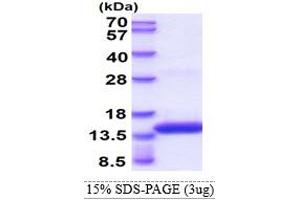 SDS-PAGE (SDS) image for Dengue Virus (DENV) (AA 298-400) protein (His tag) (ABIN5853802) (DENV Protein (AA 298-400) (His tag))