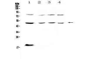 Western blot analysis of FCGR1A using anti-FCGR1A antibody .