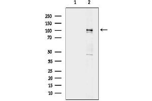 anti-Catenin (Cadherin-Associated Protein), delta 1 (CTNND1) (C-Term) antibody