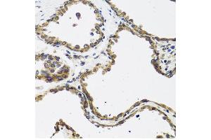 Immunohistochemistry of paraffin-embedded human prostate using CALCB antibody at dilution of 1:100 (40x lens). (CALCB anticorps)
