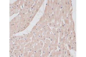 Immunohistochemistry of paraffin-embedded Rat heart using PRPF31 Polyclonal Antibody at dilution of 1:100 (40x lens). (PRPF31 anticorps)